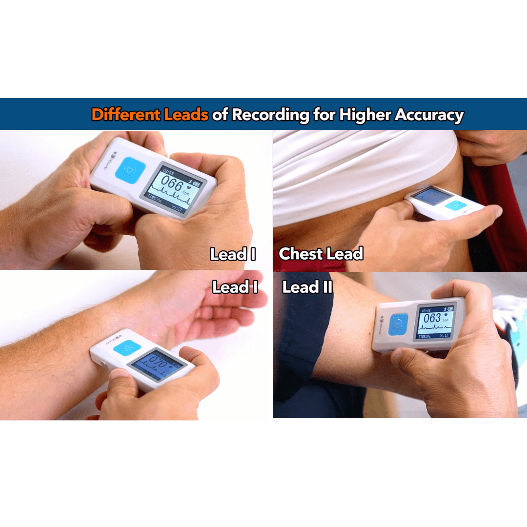 EMAY Health Monitoring EMAY Portable EKG Monitor - Available in 3 Color Options