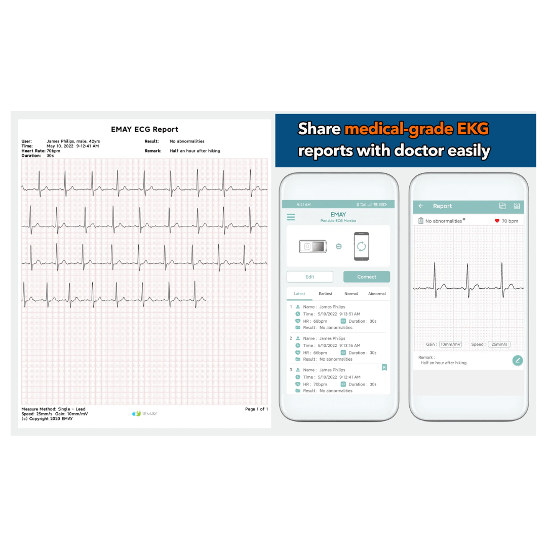 EMAY Health Monitoring EMAY Portable EKG Monitor - Available in 3 Color Options